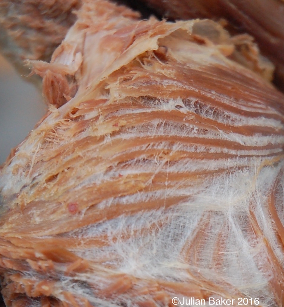 The flesh-coloured strands are muscles and the whitish material surrounding and between the muscles is the fascia.